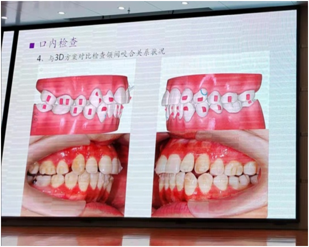 俄罗斯专享会平台294地址开展牙齿隐形矫治临床诊疗技术培训(图3)