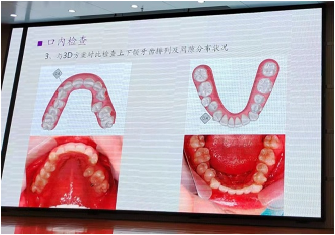 俄罗斯专享会平台294地址开展牙齿隐形矫治临床诊疗技术培训(图5)